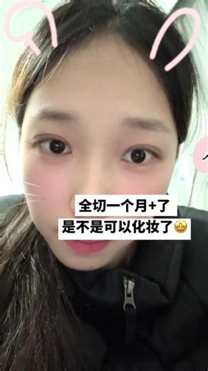 好久没更新了 号回来啦uu们 先发个今天的视频水一下 算是一起回应关心我恢复情况的姐妹们❤️ 过几天开学了还会再给大家剪视频的！等等我（最近放寒假玩疯了hhh）#双眼皮恢复记录