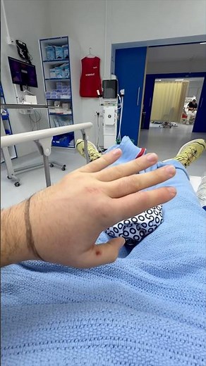 I've been bitten by a horned viper! 🩸🐍