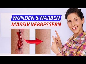 How to heal your wounds faster & scars better - 6 ultimate nutrients - tips from a doctor