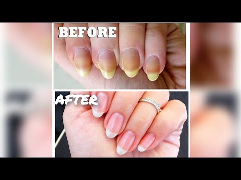 How To Keep Your Nails Clean And White | Nail Cleaning Tutorial | How to Clean Nails #nails