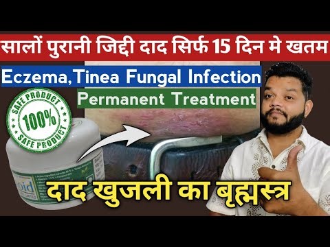 दाद खुजली से छुटकारा 🔥 Fungal Infection Permanent Treatment | Leebord Cream Uses, Benefits