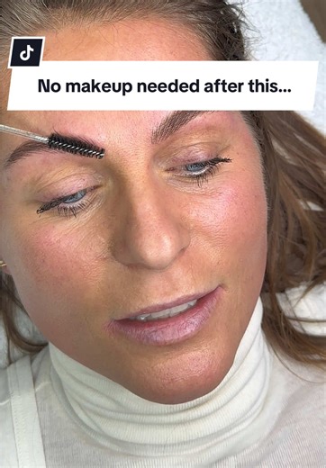 No makeup needed after this… #b#beforeafterbrowsb#beautytokf#fypforyoupage#nanobrows