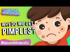 Why Do We Get Pimples? | COLOSSAL QUESTIONS | Learn #withme
