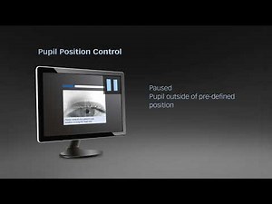 Tip Instructional – Octopus, Fixation Control