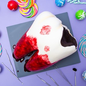 These body part cakes are to die for! This Decaying Molar Cake is the ultimate sweet tooth - with layers of chocolate cake and chocolate ganache. It features a smooth coat of plaque colored royal icing, a thick and chunky layer of strawberry jam dyed a bright bloody red, and is topped off with a tartar colored royal icing buildup - a dentist’s dream 🦷 | How To Cake It