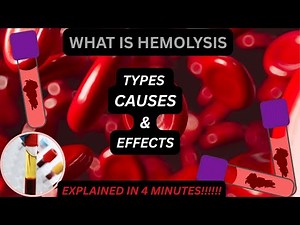 Hemolysis Explained | Hemolysis In Blood Samples|#hemoglobin #laboratory