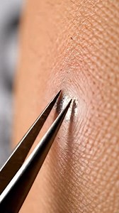 Chain link pimple pop ⛓🫧 Metallic snap, glossy pull, and perfectly satisfying ASMR. #ASMR #Slime #Satisfying #OddlySatisfying #AI | Vexx Labss