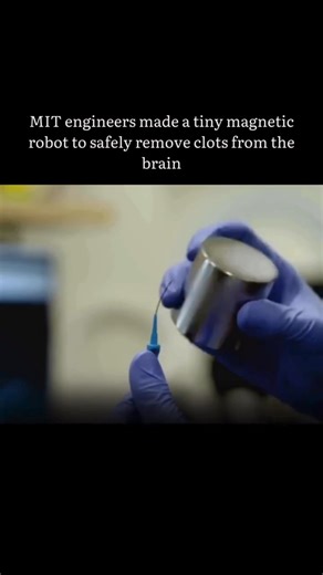 Tech Page on Instagram: "MIT engineers have developed a tiny, magnetically steerable robotic thread designed to safely navigate the brain’s intricate blood vessels to remove blood clots. This innovation aims to provide a less invasive alternative to traditional surgical methods for treating conditions like strokes and aneurysms . . . #ai #technology #artificialintelligence #machinelearning #innovation #robotics #tech"