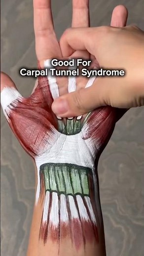 How To Massage Carpal Tunnel Syndrome! #carpaltunnelsyndrome #massage #trendingshorts