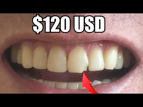 American Tries Mexican Dentist - Here's What Happened