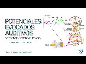 POTENCIALES EVOCADOS AUDITIVOS DE TRONCO CEREBRAL.