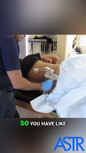 Release Scar Tissue Fast with ASTR #shorts