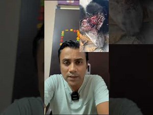 How to treat a maggot wound.