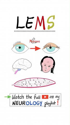 Instagram video by Medicosis Perfectionalis • Oct 27, 2024 at 1:09 PM