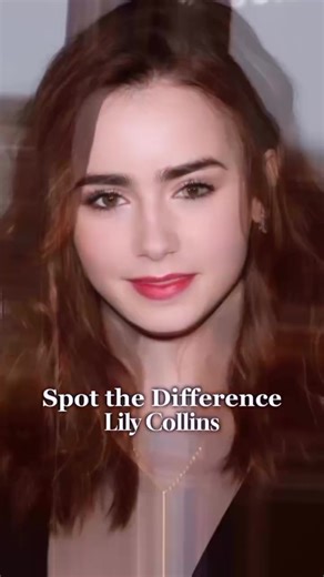 Yes, the haircut is slaying… but let’s be honest, the glow, refinement and balance are giving well-executed aesthetics energy 😌 She looks stunning! What do you think… haircut only, or a little subtle enhancement happening too? 👀 👇🏻 Rp @injectorjess ⚕️Lea Henderson DNP, FNP- BC 💻 leahenderson.com 📍Albuquerque, NM . . . . . #lillycollins #lipfiller #browlift #facelift #hoodedeyes