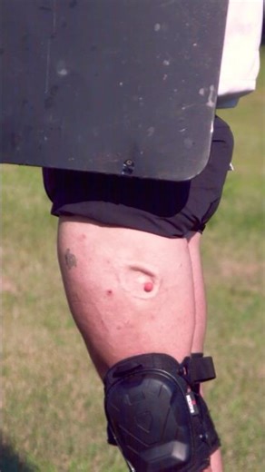 I SHOT A CHUNK OF MY LEG OFF 😱 #shorts #funny #entertainment