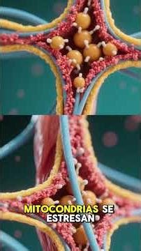 Spinal muscular atrophy (SMA)