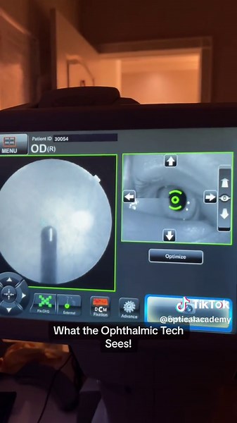 Your perspective vs. Our view during your eye exam! Share your unexpected eye exam stories below! 👀 Let’s start a conversation in the comments! 🗨️ A fundus photo is like having a special camera for your eyes. It captures detailed images using light to reveal all the layers inside your eyes. When we incorporate it into your routine eye check-up, we gain incredibly precise insights into the health of your eyes. It’s like getting a high-definition view of what’s going on inside, helping us ensure