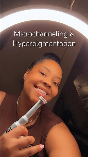 Microchanneling with Procell to target hyperpigmentation and strengthen the skin