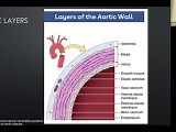 Echocardiography and the Aorta: Fundamentals and Beyond • Video • MEDtube.net
