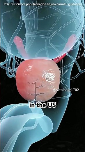 Prostate Cancer Explained #animation #anatomy #prostatecancer #cancer #health #doctor #facts