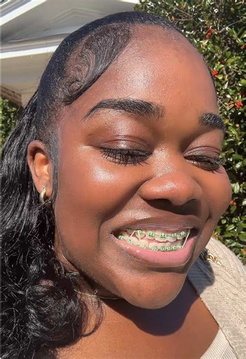 Picking your next braces color could literally make or break you! 😖 #missanne #christiancreator #braces #bracescolors