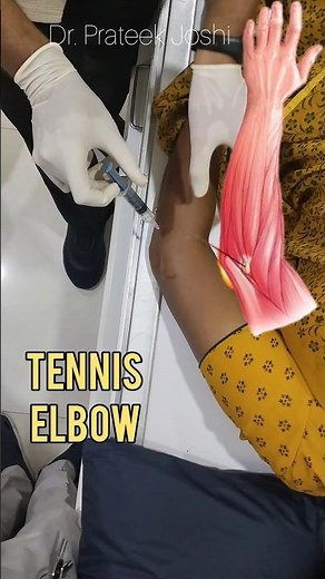 Tennis Elbow Steroid Injection | #ortho #elbow #tenniselbow #steroid #injection