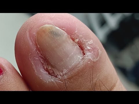 Pedicure Co-worker #satisfying Neldz SOLO Parent is live!