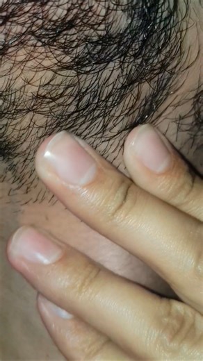 Asmr hair #beard #relaxing #massage #therapy #haircare #hairgrowth #diy #ingrownhair #shorts #video