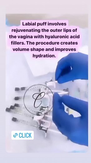 Understanding Labial Puffing: Enhancing Vaginal Aesthetics