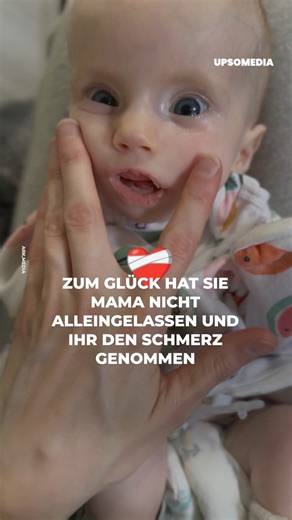 1.3M views · 3.1K reactions | Das kleine Mädchen lebt mit dem Möbius-Syndrom, aber zum Glück ist die Mutter zur Stelle, um ihr zu helfen. | Positiv + | Facebook
