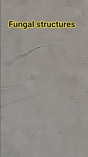 Fungal structures microscopy