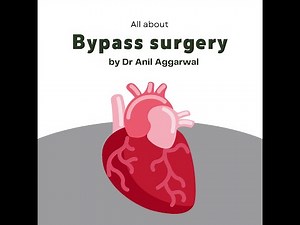 All About Bypass Surgery Procedure by Dr Anil Aggarwal