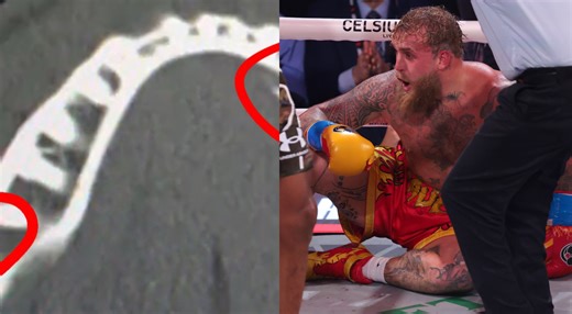 Jake Paul Posts Horrifying X-Ray Confirming "Double Broken Jaw" After KO Loss To Anthony Joshua [PHOTO]