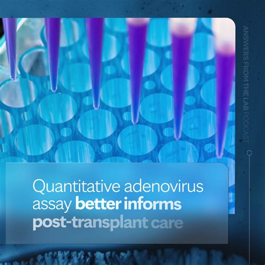 Adenovirus testing is recommended for transplant patients when tests for more common viruses, such as Epstein-Barr, are negative. Our new adenovirus quantification assay goes beyond typical qualitative testing to better manage patient care. https://bit.ly/4os3iL2 | Mayo Clinic Laboratories