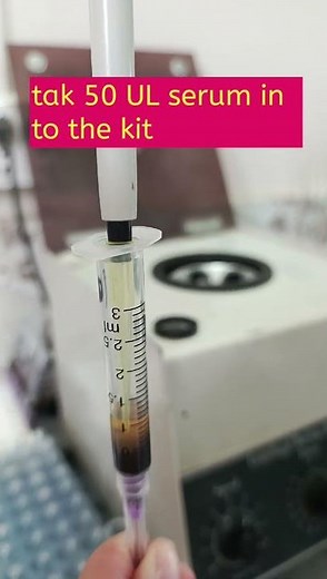 VDRL test in Laboratory.