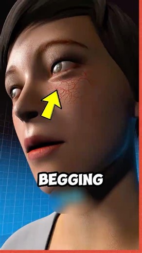 Never Ignore a Twitching Eye 👀⚠️ Here's Why