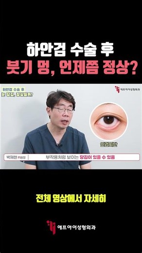 하안검 수술 후 붓기 멍, 언제쯤 정상? #에프아이성형외과