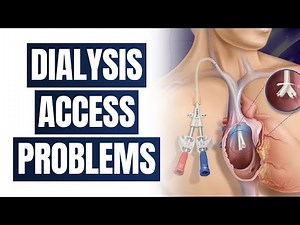Common Dialysis Access Problems Explained: Catheter, Fistula, & Graft