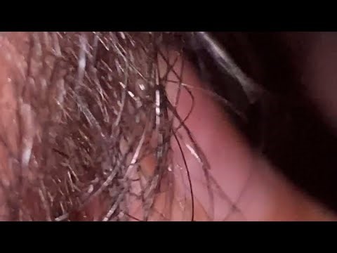 ASMR Satisfying Beard Hair Massage Therapy 😌