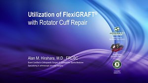 Utilization of FlexiGRAFT® with Rotator Cuff Repair