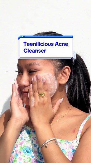 Teenilicious Acne Cleanser: Bye Bye Acne Breakouts!