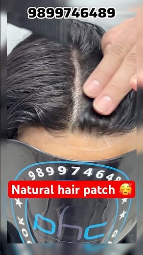 Ranking No 1 Top Notch Best quality natural look hair patch 🤩| #hairpatch #wigs #trending #viral |