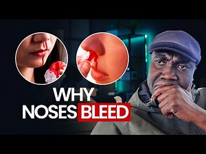 The Real Reason Your Nose Bleeds!