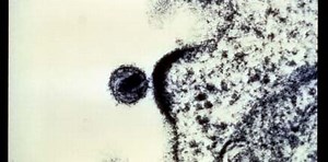 Compounds coax HIV out of hiding so it can be eliminated