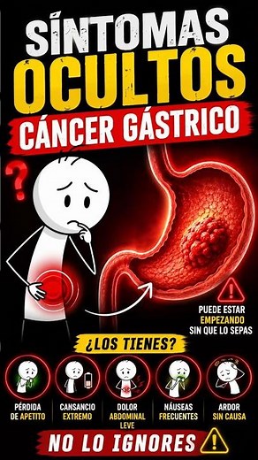 HIDDEN SIGNS OF STOMACH CANCER #gastriccancer