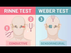 Rinne & Weber Test Explained | Conductive vs Sensorineural Hearing Loss