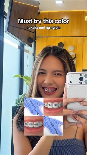 Must try this Periwinkle Color it whitens your teeth | Mae Gabales