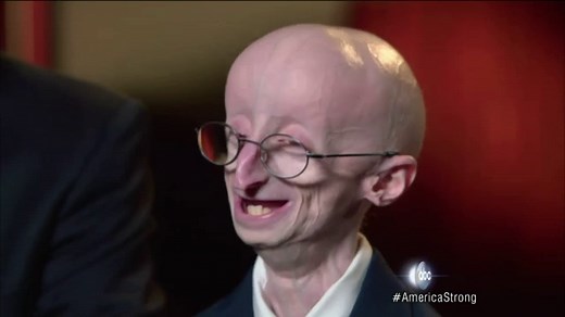 The Triumphant Story of Sam Berns, Progeria and Math