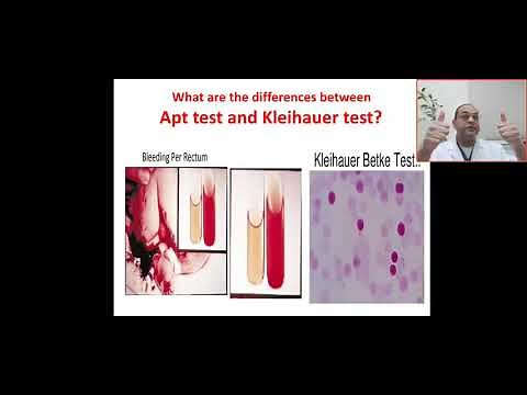 What are the differences between Apt and klehauer- Betke test ? Swallowing maternal blood, Rh sent.
